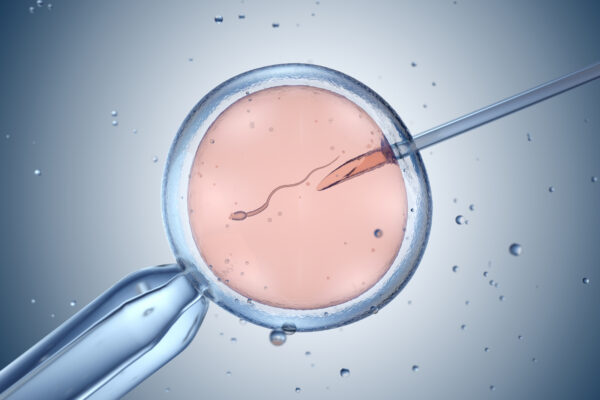 Intracytoplasmic Sperm Injection, ICSI as part of IVF